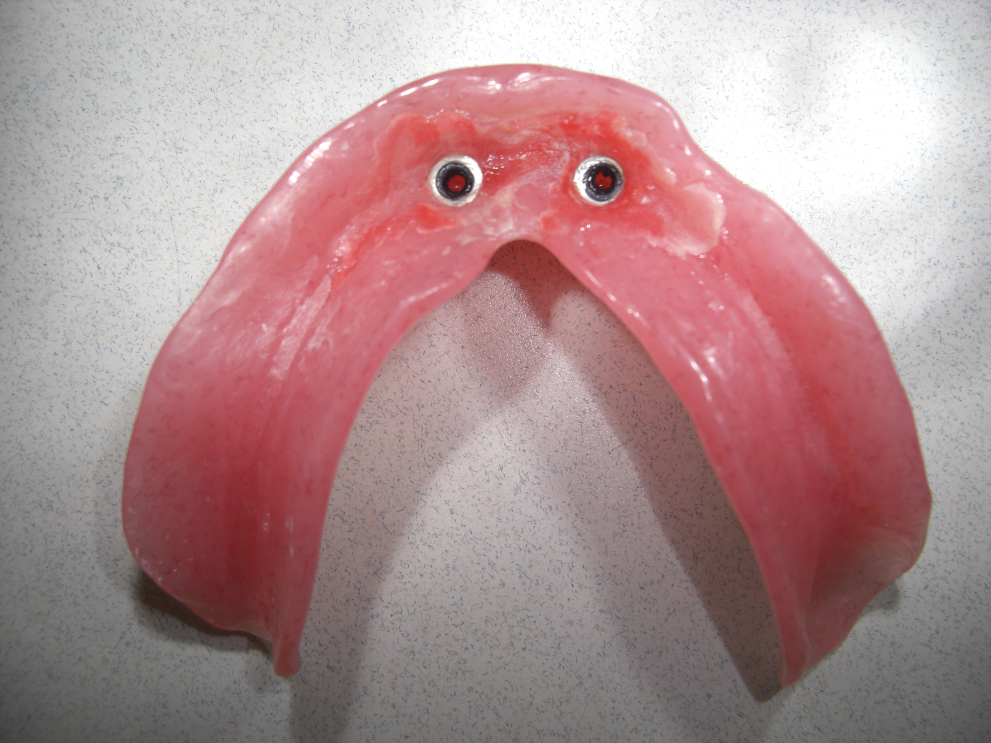 入れ歯の人工歯の排列 画像3