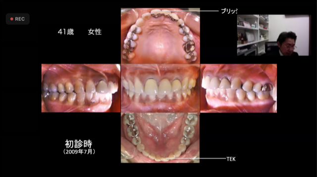 ズームでの学術講習会