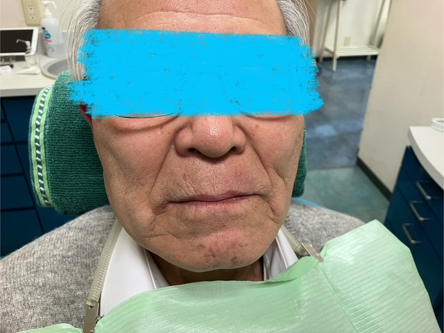 インプラント手術のお知らせ