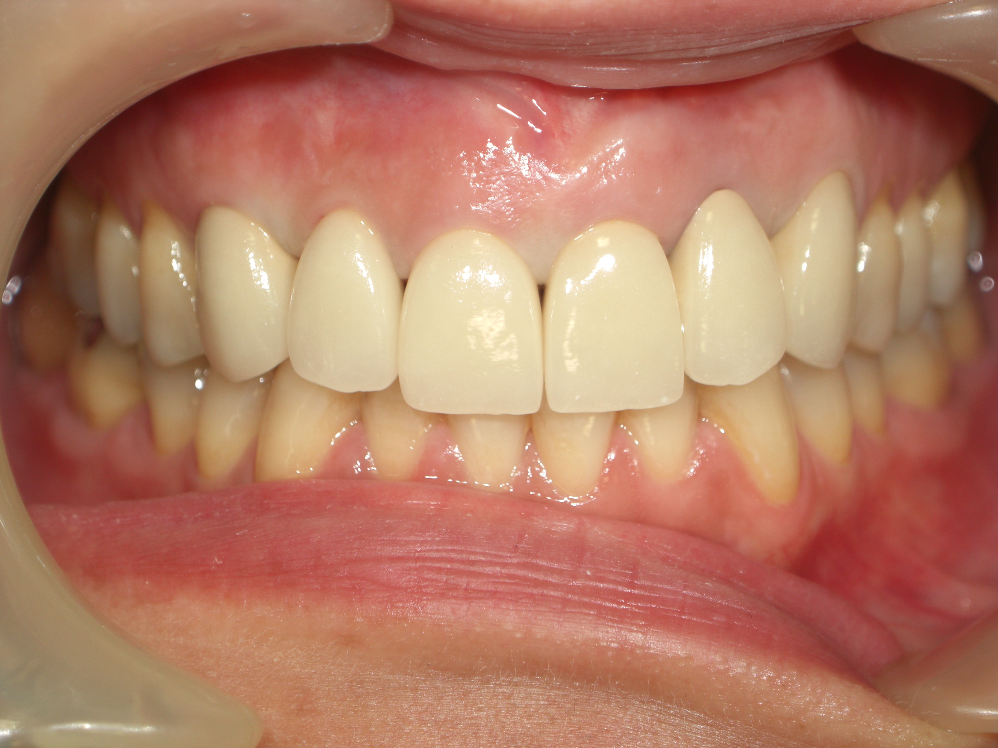 歯科技工士さん 画像9